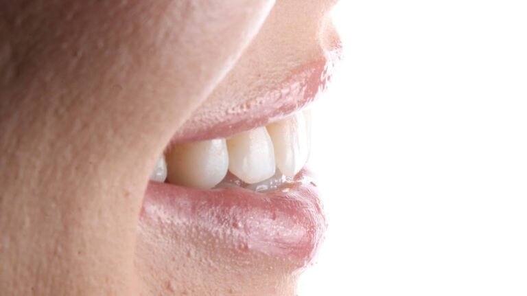 Before and after cosmetic dental treatment by Dr Shreya Rajkumar, Dubai Silicon Oasis & Lucknow
