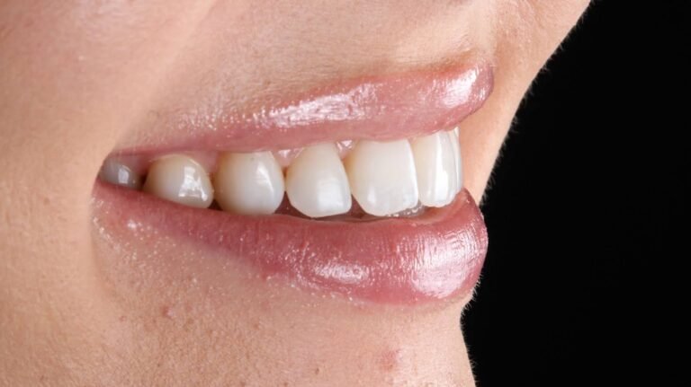Before and after cosmetic dental treatment by Dr Shreya Rajkumar, Dubai Silicon Oasis & Lucknow